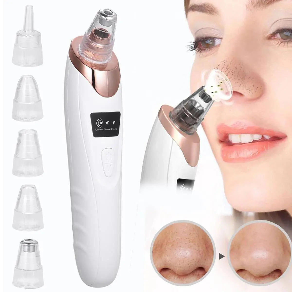 Blackhead Remover Electric Vacuum Pore Cleaner Facial Suction Digital-dream