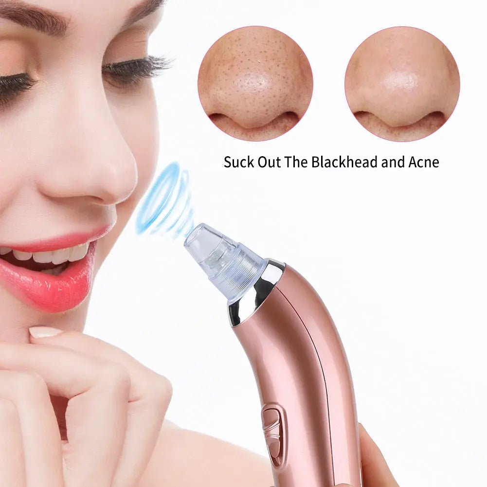 Blackhead Remover Electric Vacuum Pore Cleaner Facial Suction Digital-dream